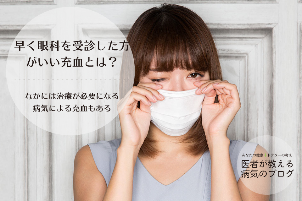 早く眼科を受診した方がいい充血とは?