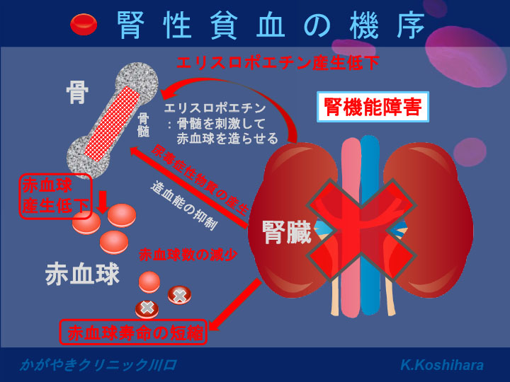 腎性貧血の機序