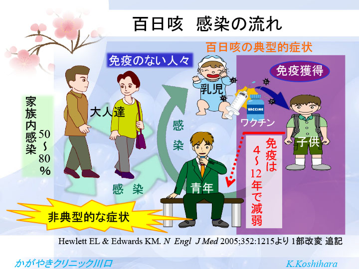 クループについて